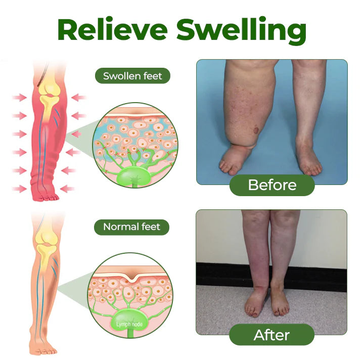 Professional Leg Circulation Cream
