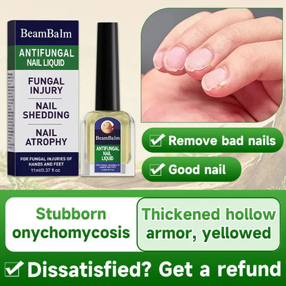 Maximum Strength Comprehensive Toenail Fungus Solution | Triple Action Formula Fights Fungus, Clears Yellow & Thick Nails, Fast Itch Relief