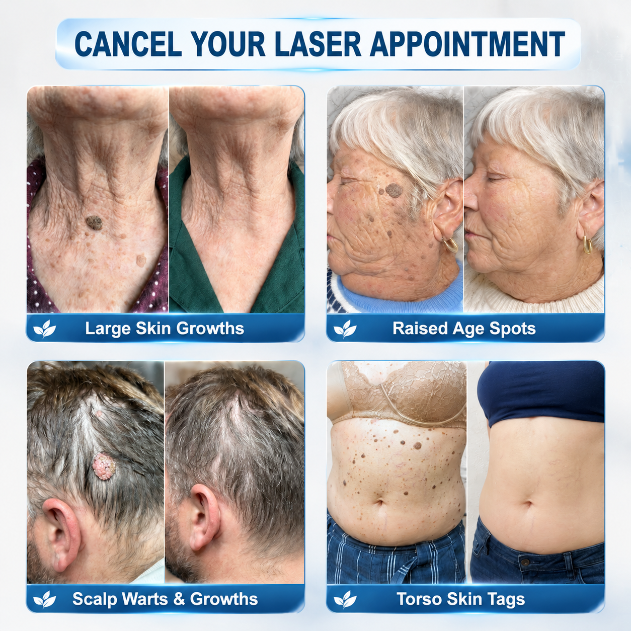 𝐎𝐟𝐟𝐢𝐜𝐢𝐚𝐥 𝐁𝐫𝐚𝐧𝐝 𝐒𝐭𝐨𝐫𝐞 |🧿𝐏i𝐜𝐝o® 7-𝐷𝑎𝑦 𝗧𝐚𝐠 & 𝗦𝗽𝐨𝐭 𝐄𝐫𝒂𝒔𝒆𝒓(Zero Pain, Zero 𝐒𝐜𝐚𝒓𝒔 Rollerball)💦